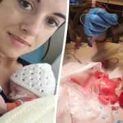 Mum has one of smallest babies ever born in UK weighing 350g